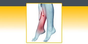 A picture of a person 's leg with a broken bone.