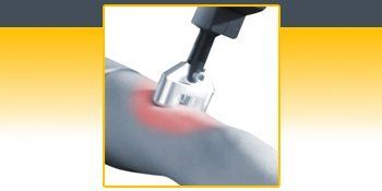 A person is getting a laser treatment on their arm. A person is getting a laser treatment on their arm.