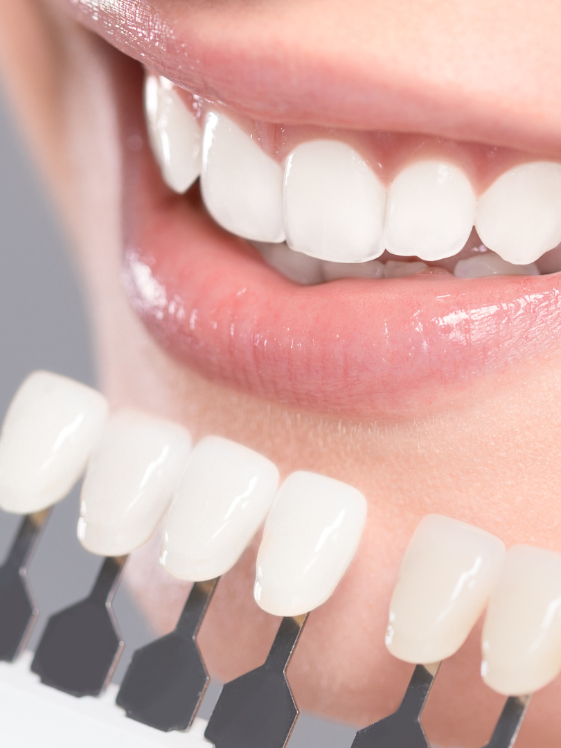 A woman is smiling while sitting in a dental chair.