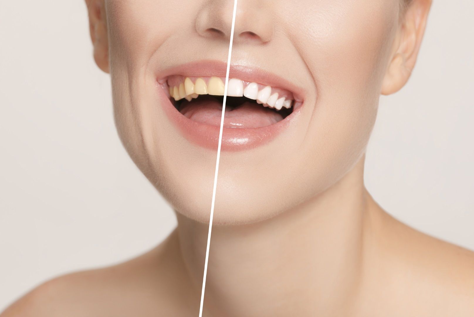 A woman is smiling while sitting in a dental chair.