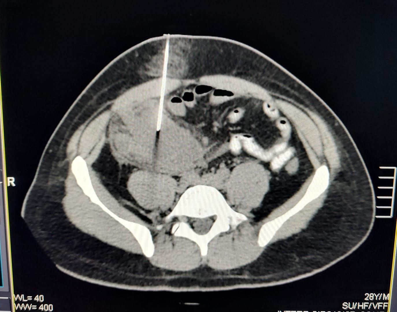 Dr. Carlos R. Colombres