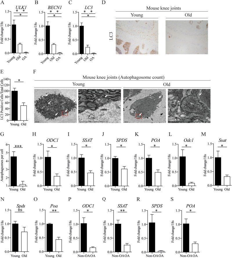 Spermidine restores dysregulated autophagy and polyamine synthesis in aged and osteoarthritic chondrocytes via EP300