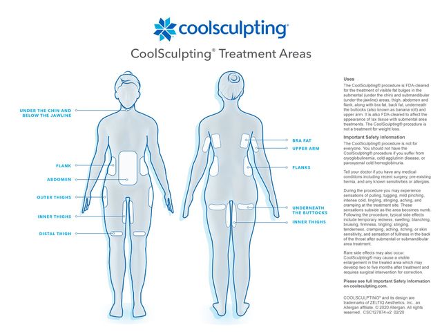 CoolSculpting® Upper Flanks