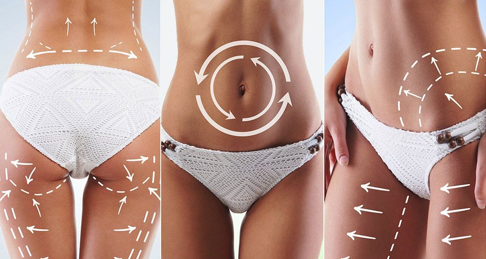 A Chart Showing the Different Areas of Body Contouring Treatments offered