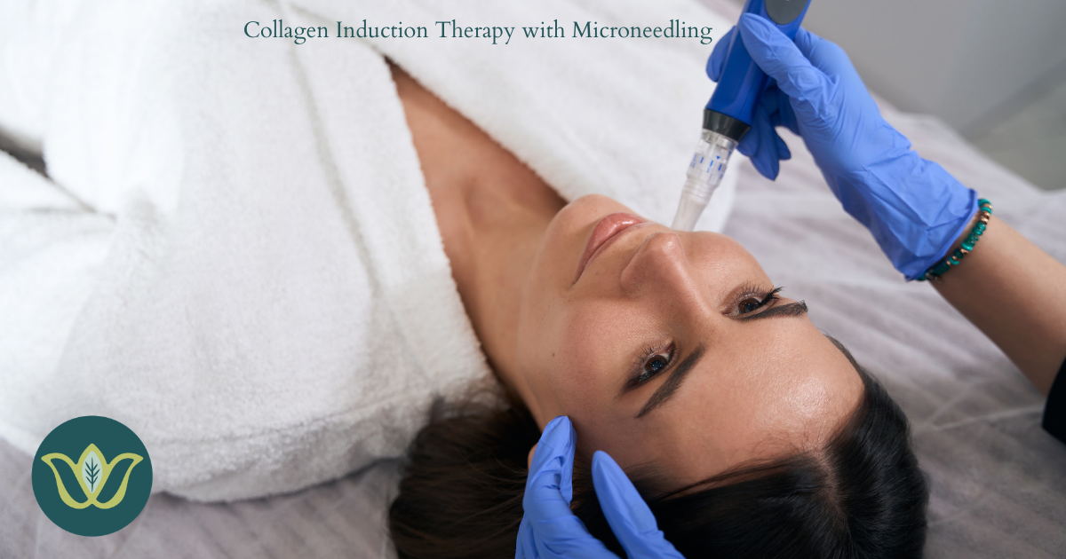 Woman receiving microneedling treatment on her face. Doctor wearing blue gloves.