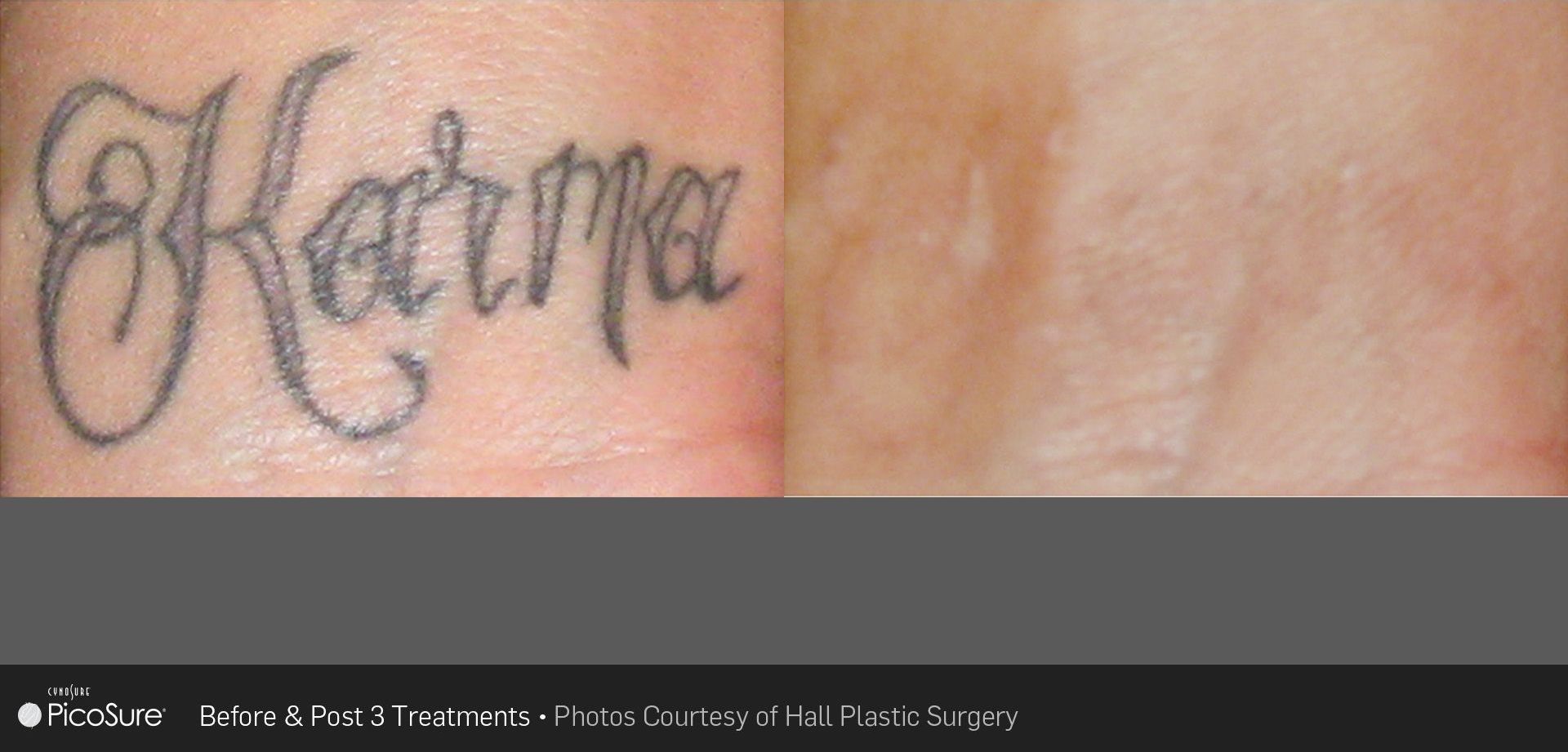 A before and after picture of a tattoo that says katrina
