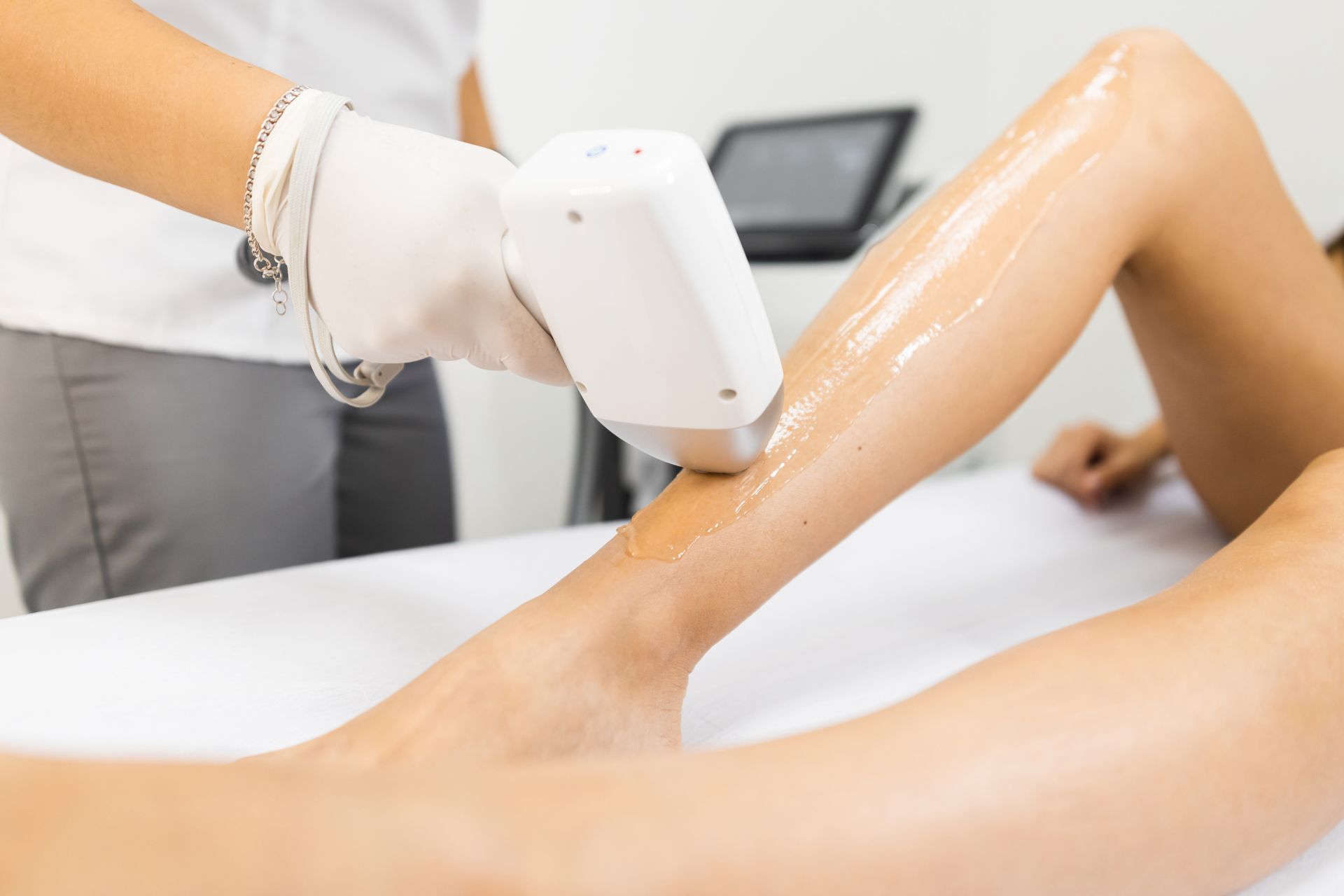 laser hair removal treatment on legs