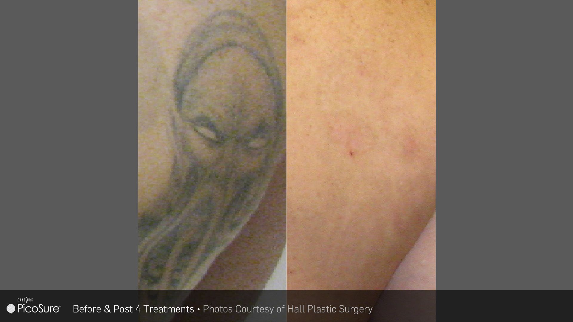 A before and after picture of a tattoo on a person 's arm.