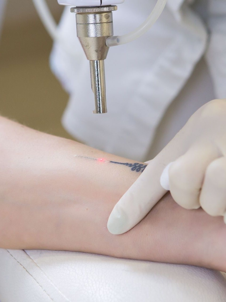 A person is getting a tattoo removed from their arm.