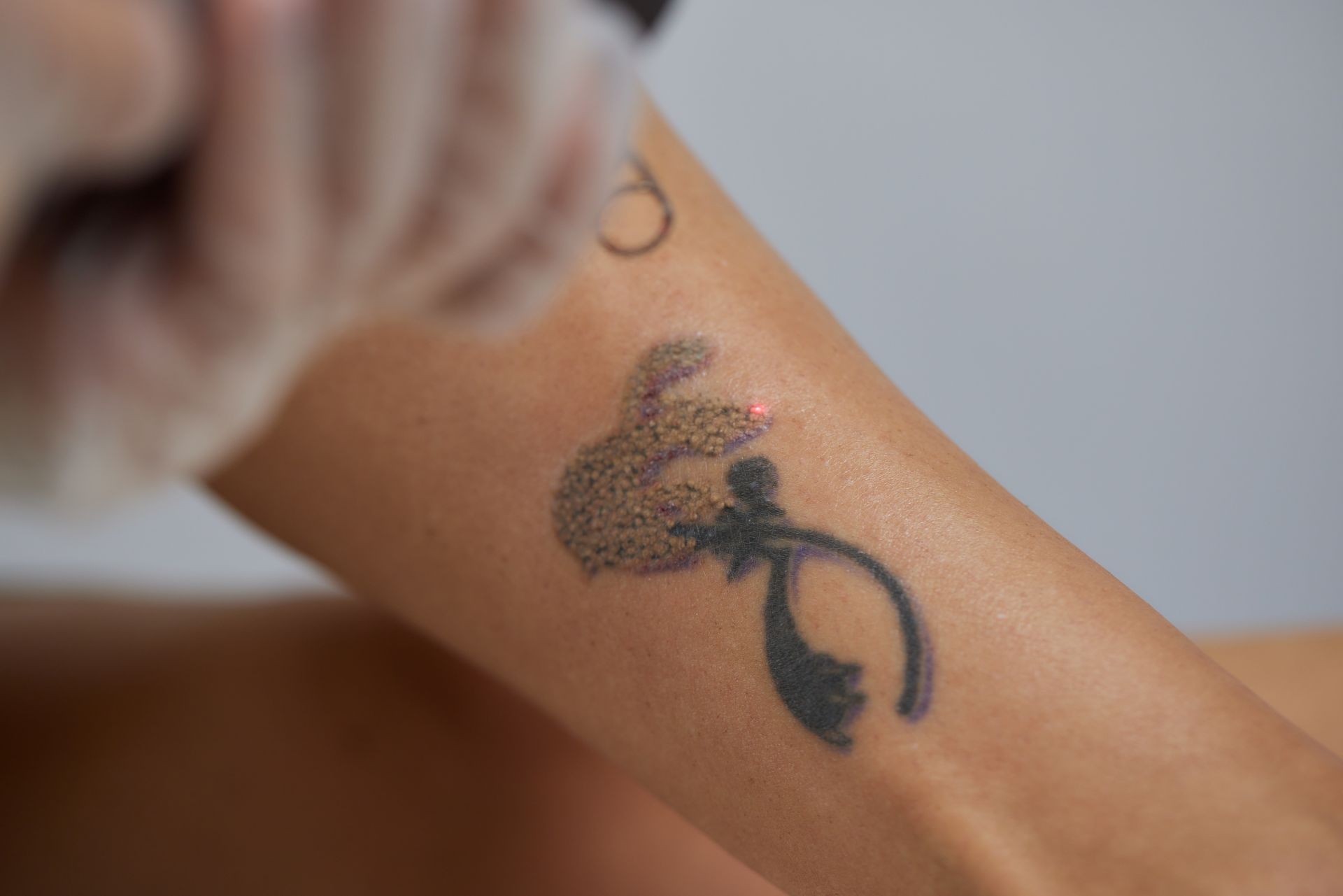 A close up of a person 's arm with a tattoo on it.