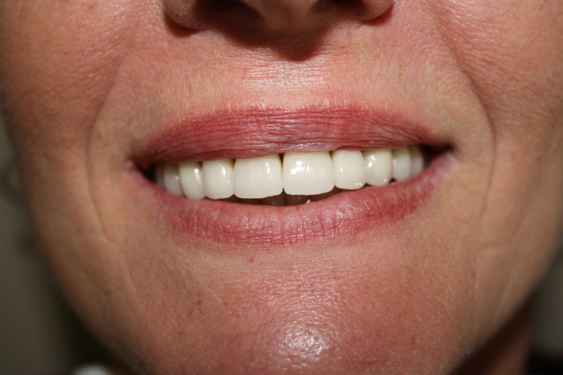 Smiling Customer — Florence, AL — Johnson & Mahan Dental Care