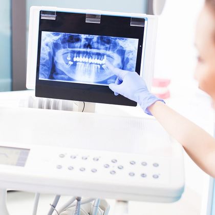 Dentist Explaining X-Ray Picture to Patient — Florence, AL — Johnson & Mahan Dental Care