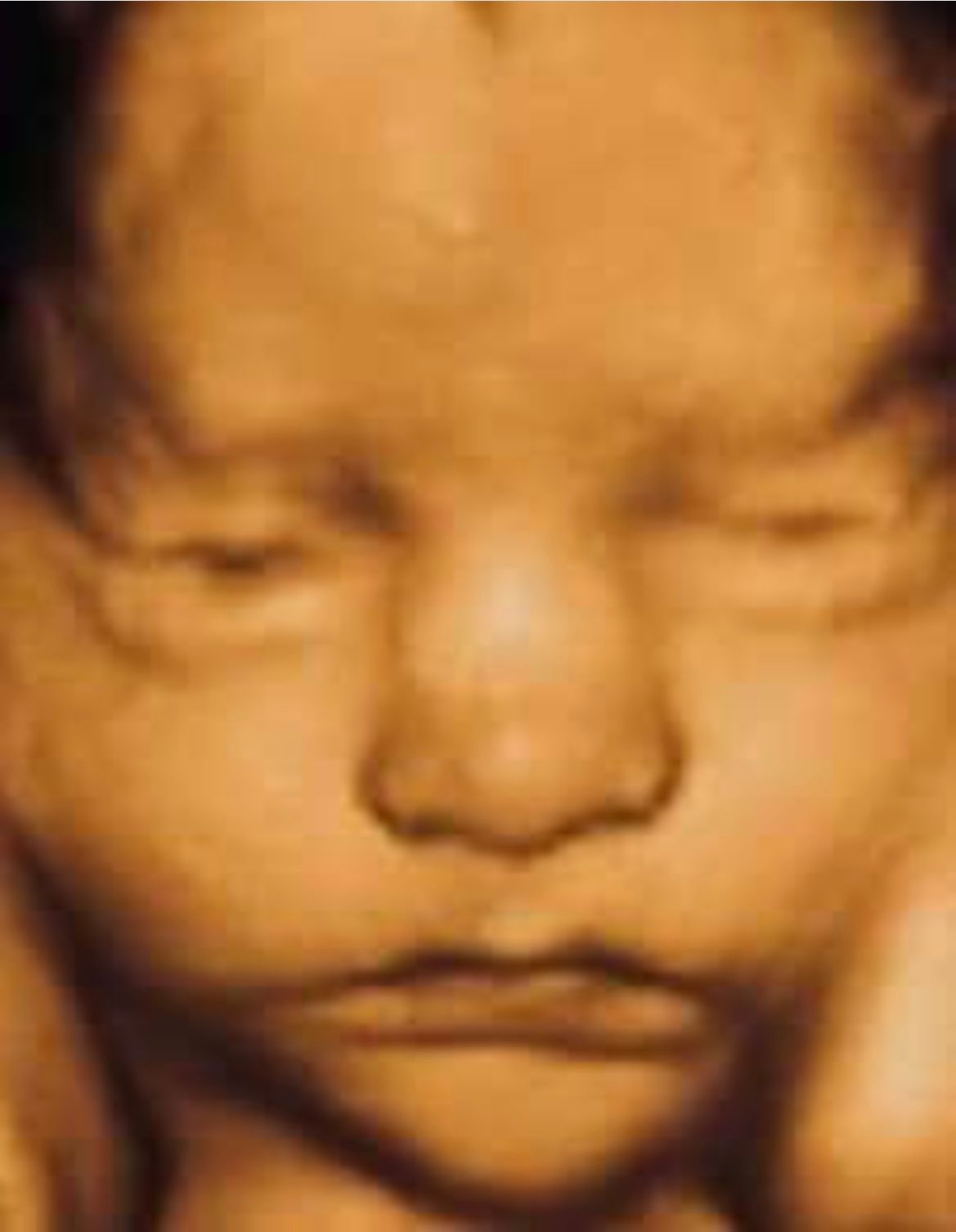 Full Early Baby Face — Greencastle, PA — Baby to Be Boutique