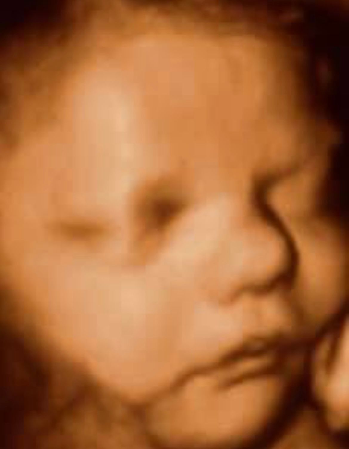 Early Full Baby Face Detail — Greencastle, PA — Baby to Be Boutique