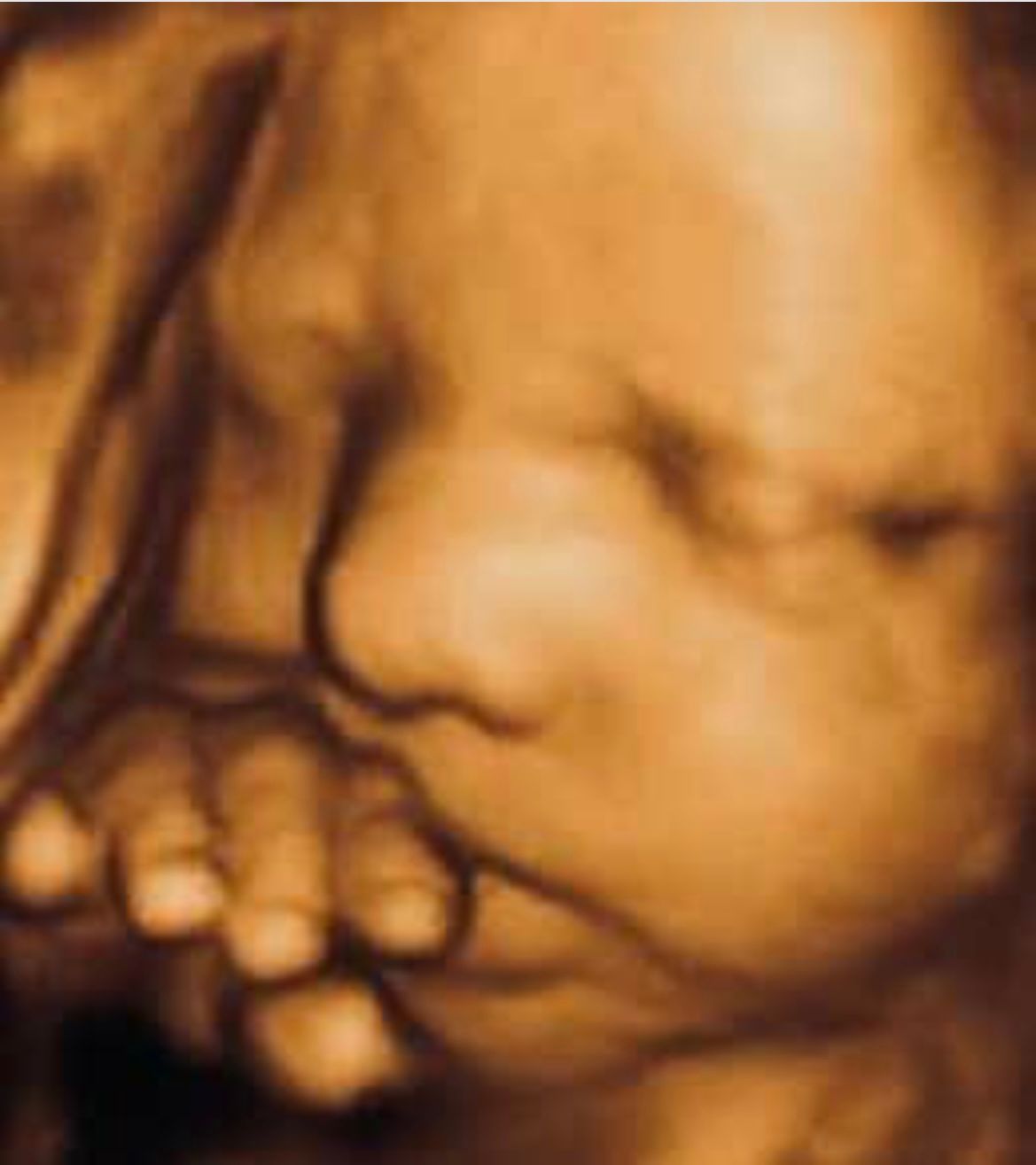 Early Baby Face and Fingers — Greencastle, PA — Baby to Be Boutique