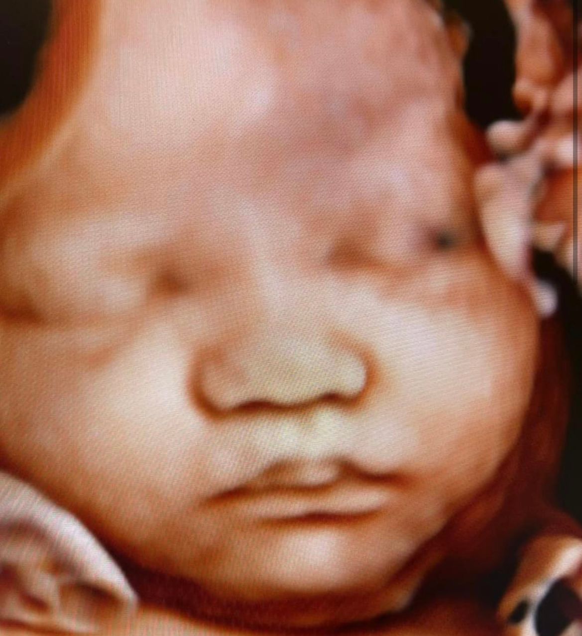 Close-up Baby Image — Greencastle, PA — Baby to Be Boutique