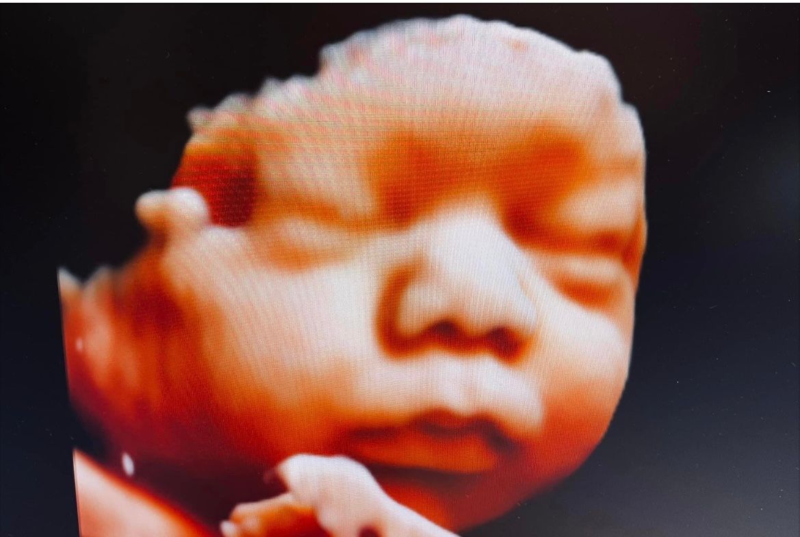 Early Baby Face — Greencastle, PA — Baby to Be Boutique