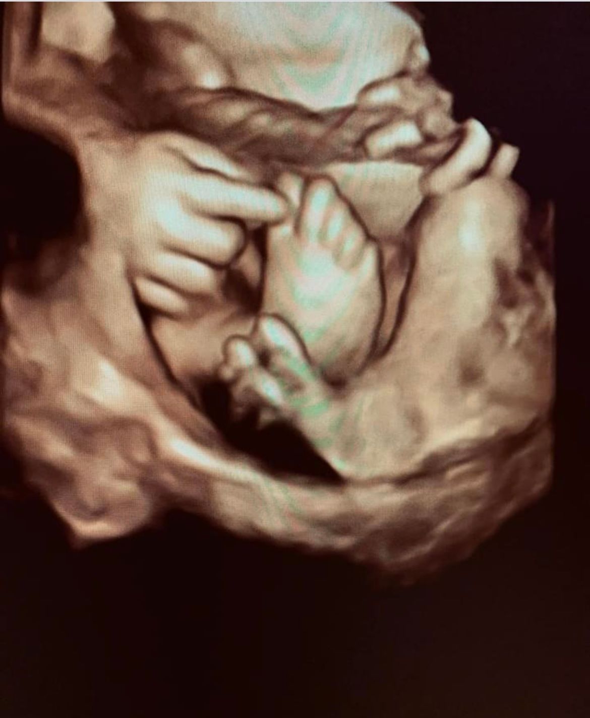 Very Early Baby Images — Greencastle, PA — Baby to Be Boutique