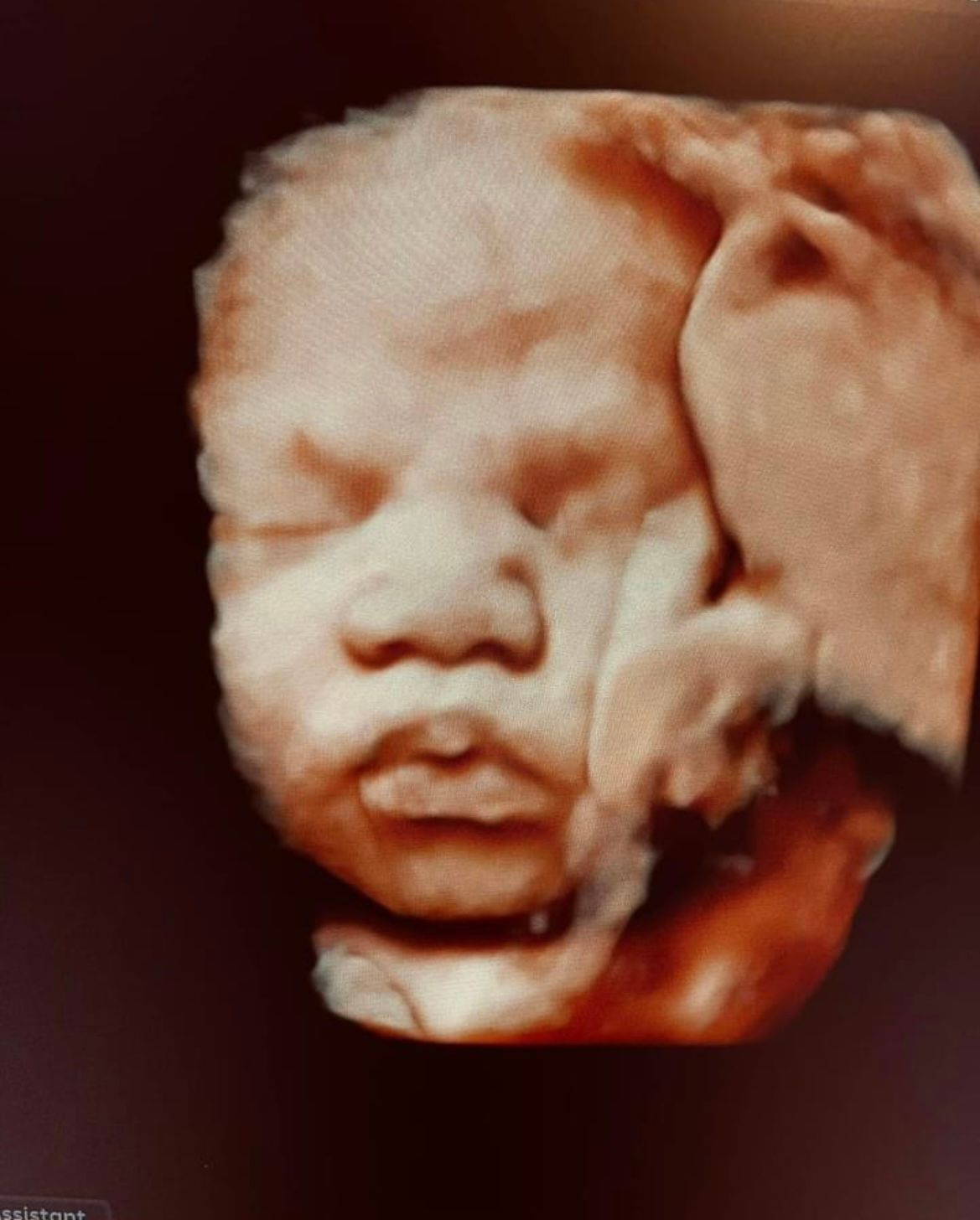 First Baby Image — Greencastle, PA — Baby to Be Boutique