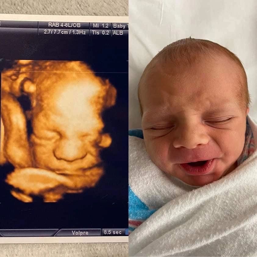 Uncomfortable Baby Face — Greencastle, PA — Baby to Be Boutique