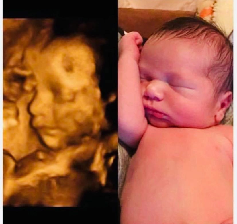 Ultrasound Gallery Greencastle, PA Baby to Be Boutique