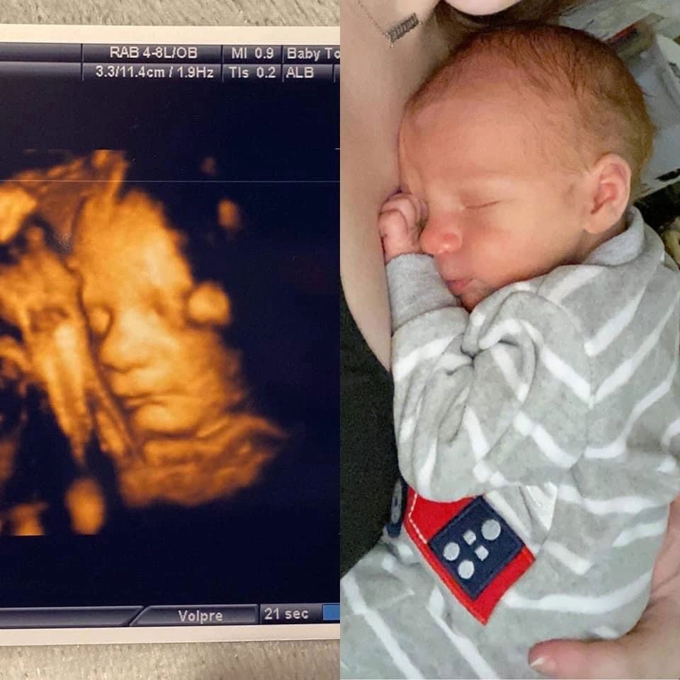 Ultrasound Gallery Greencastle, PA Baby to Be Boutique