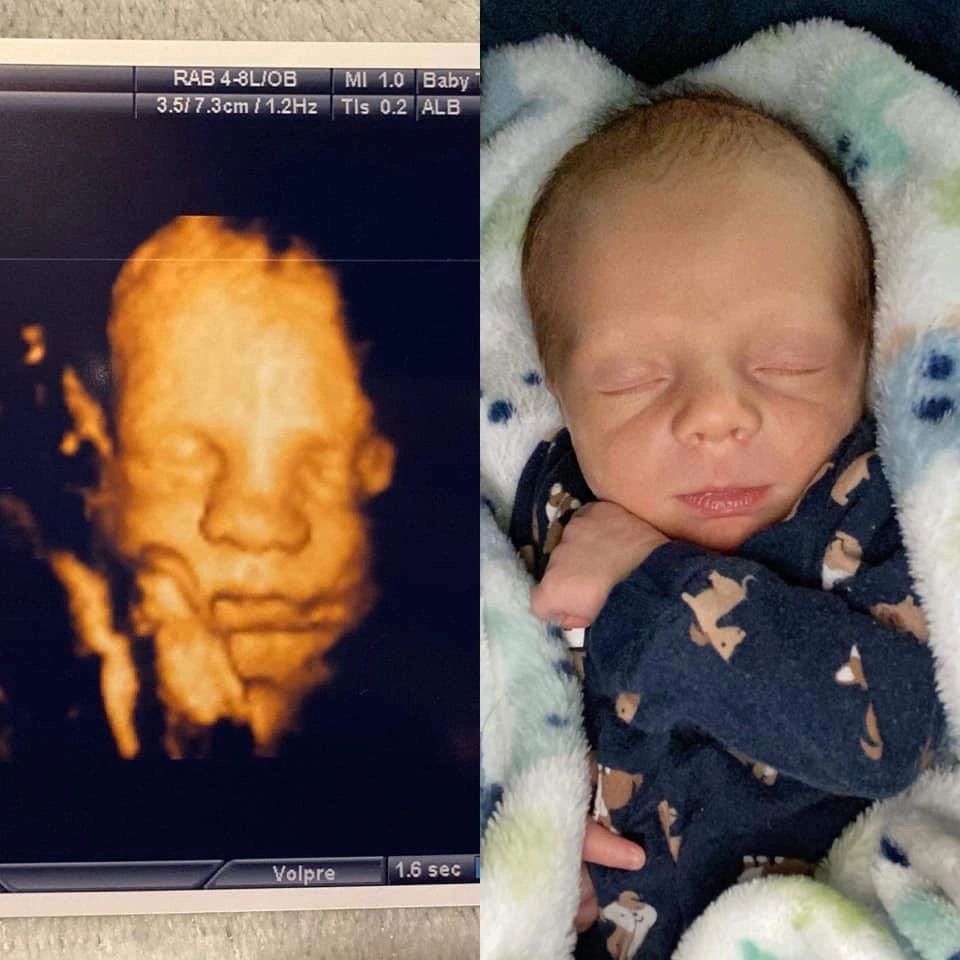 Ultrasound Gallery Greencastle, PA Baby to Be Boutique