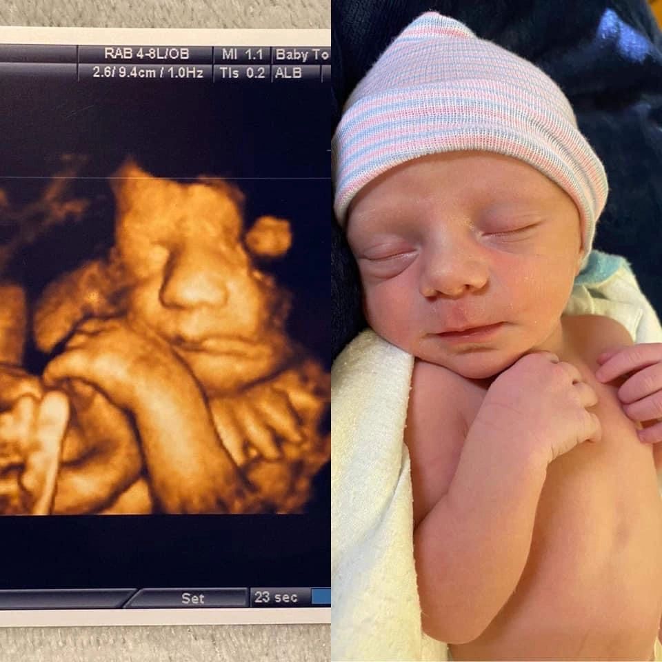 Ultrasound Gallery Greencastle, PA Baby to Be Boutique