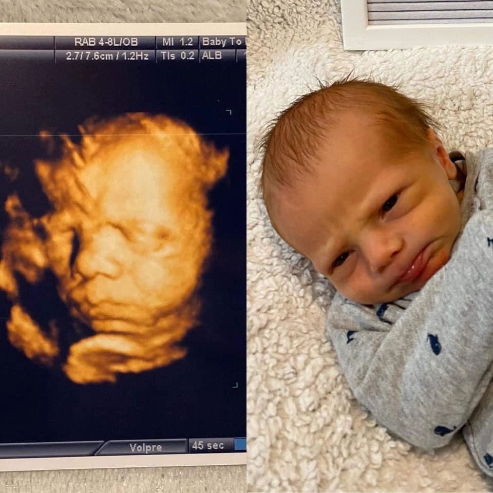 Ultrasound Gallery Greencastle, PA Baby to Be Boutique