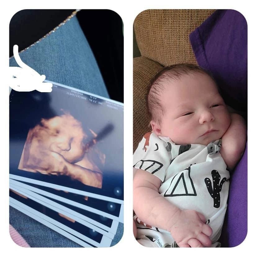 Ultrasound Gallery Greencastle, PA Baby to Be Boutique