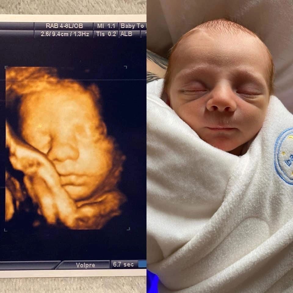 Ultrasound Gallery Greencastle, PA Baby to Be Boutique