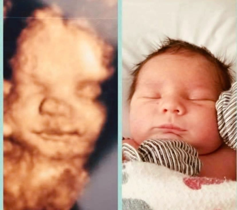 Ultrasound Gallery Greencastle, PA Baby to Be Boutique