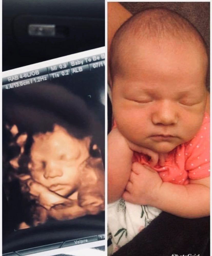 Ultrasound Gallery Greencastle, PA Baby to Be Boutique