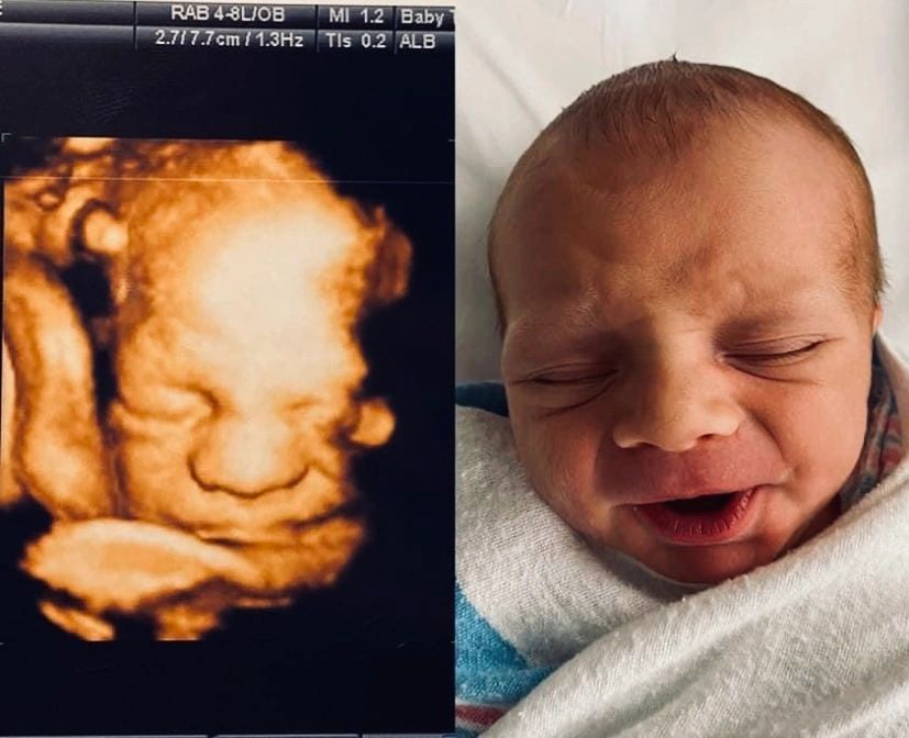 Ultrasound Gallery Greencastle, PA Baby to Be Boutique