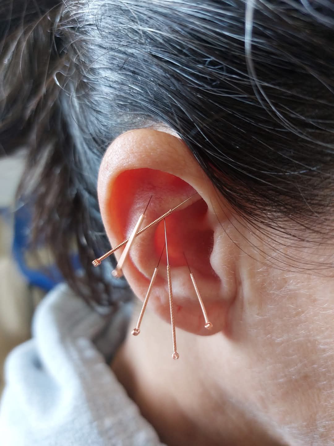 תמר דרוקר - רפואה משלימה - הסמכות