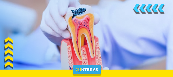 Canal dentário; endodontia