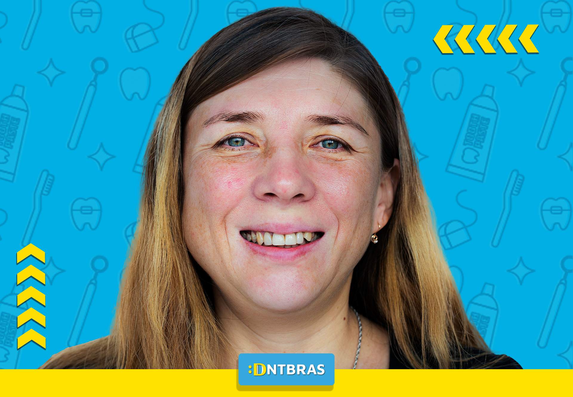 Mulher sorrindo com descoloração dental; saúde bucal; DNTBRAS; dentista