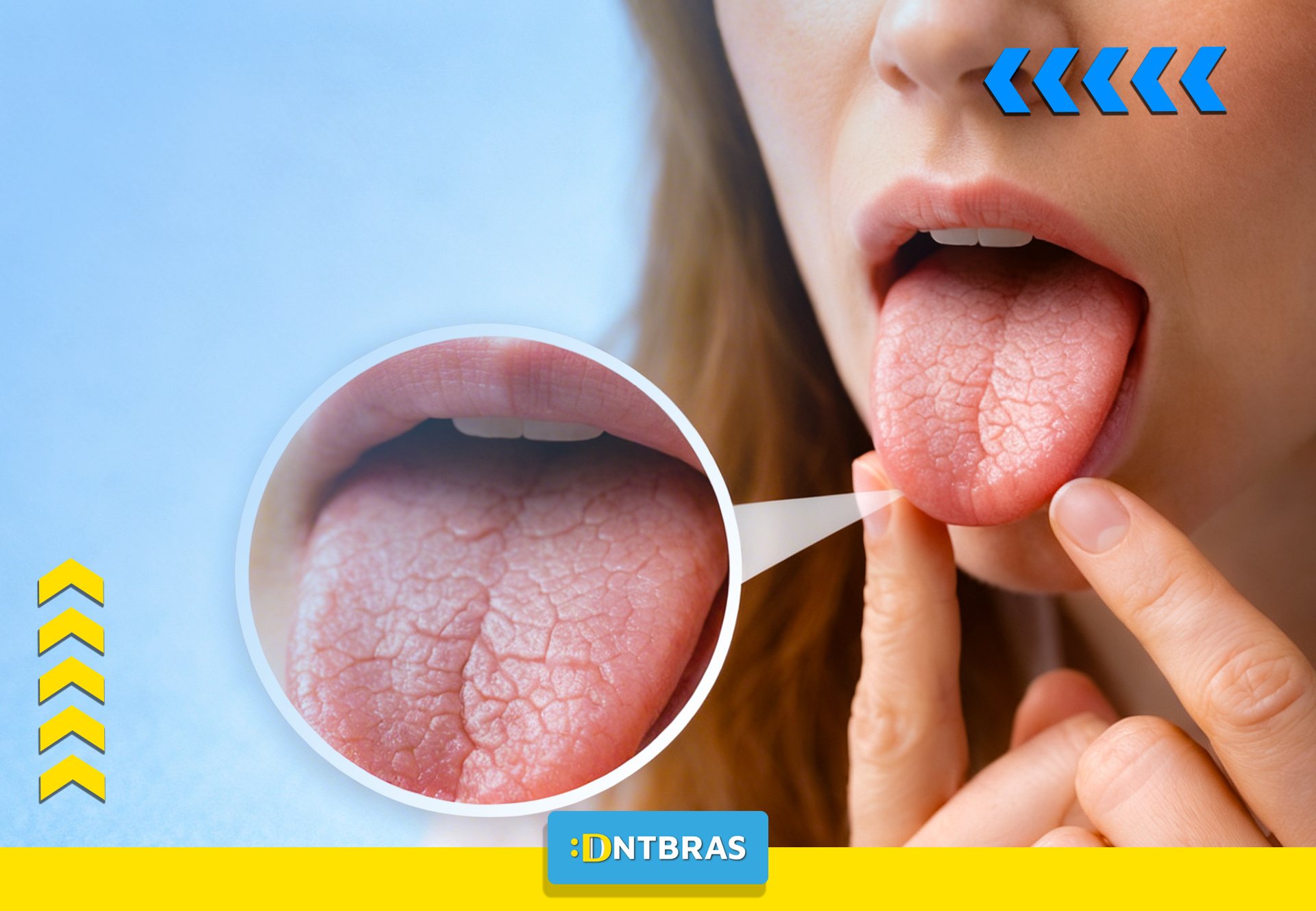 xerostomia, boca seca, saúde bucal, dentista, DNTBRAS