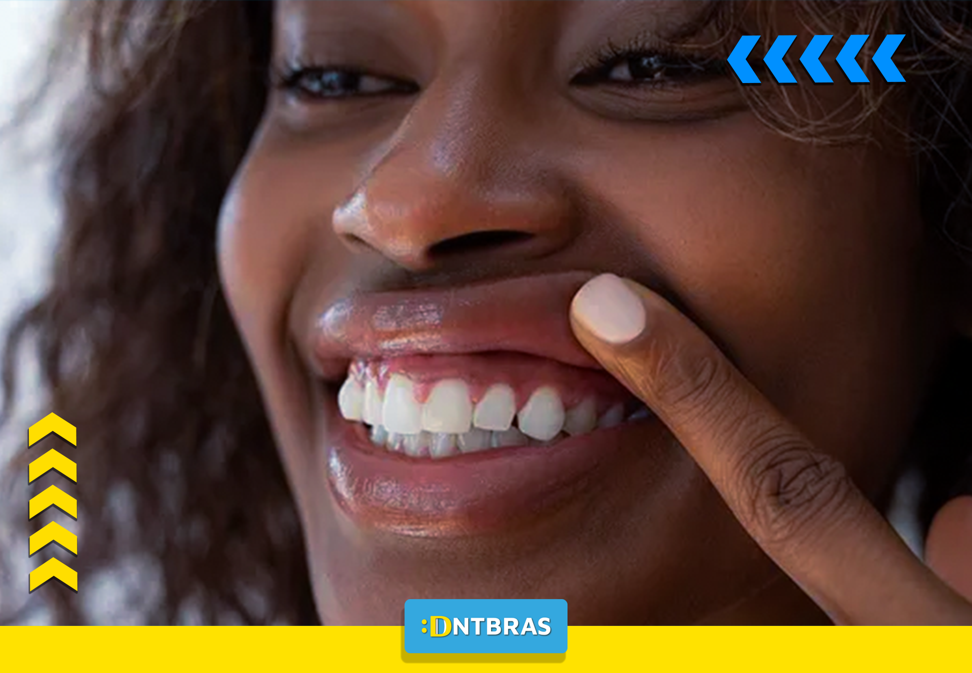 Gengivas; Gengivas saudáveis; dentistas; Saúde bucal; DNTBRAS