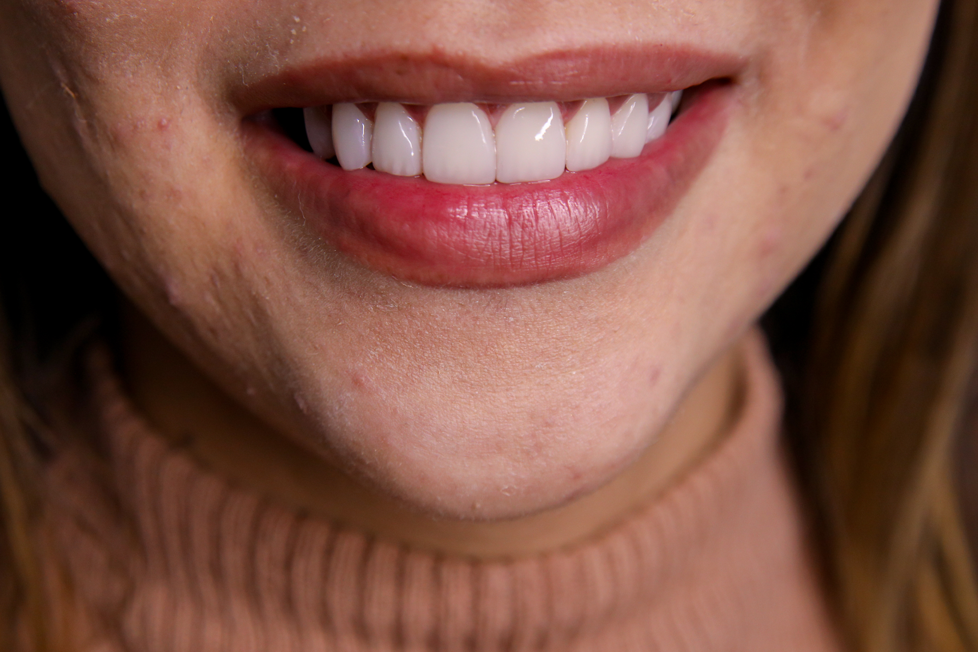 um homem de camisa azul está sorrindo com os braços cruzados.