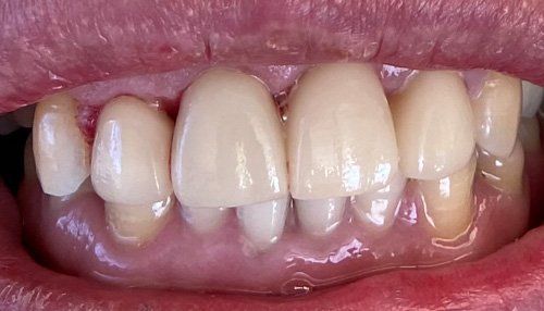 patient after treatment with a healthy smile