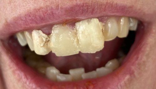 patient before teeth treatment