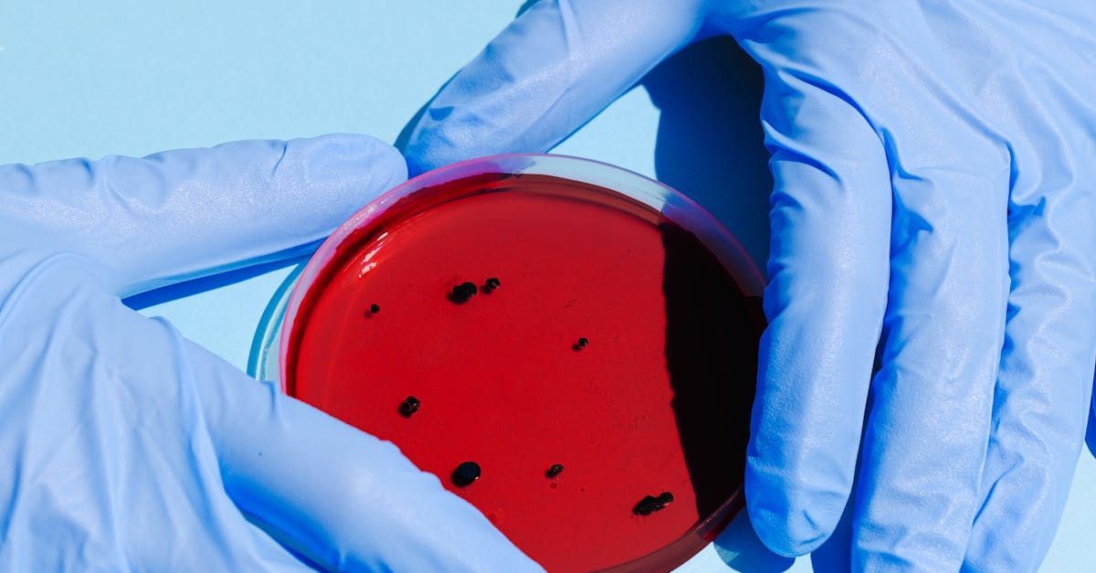 A person wearing blue gloves is holding a petri dish with red liquid in it.