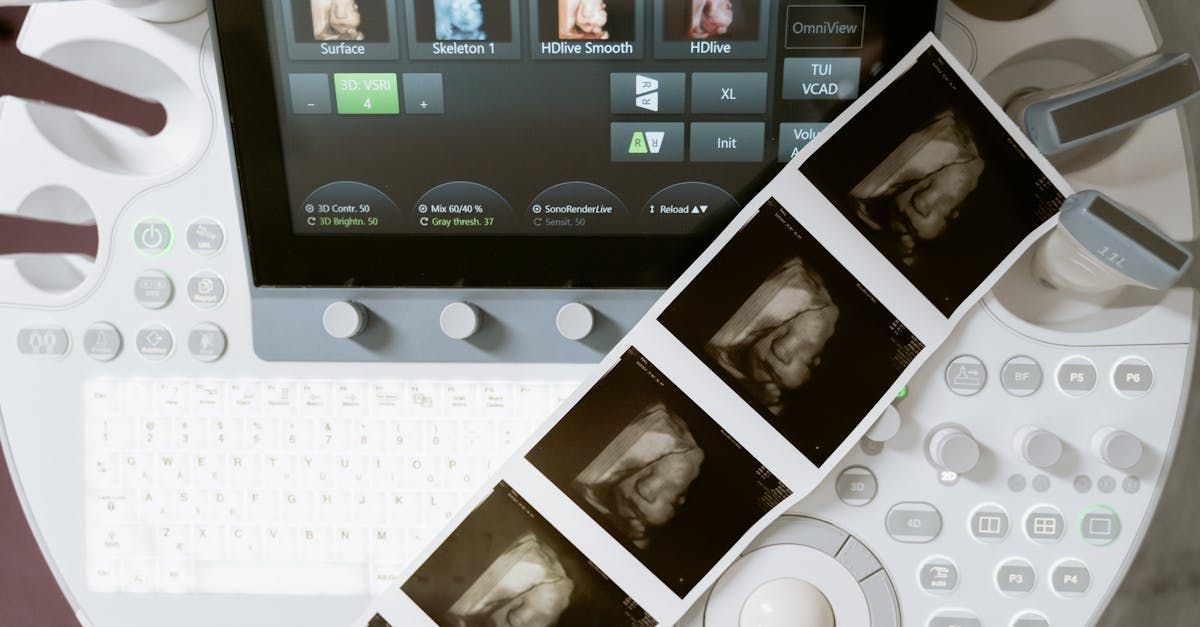 An ultrasound machine with pictures of a baby on it