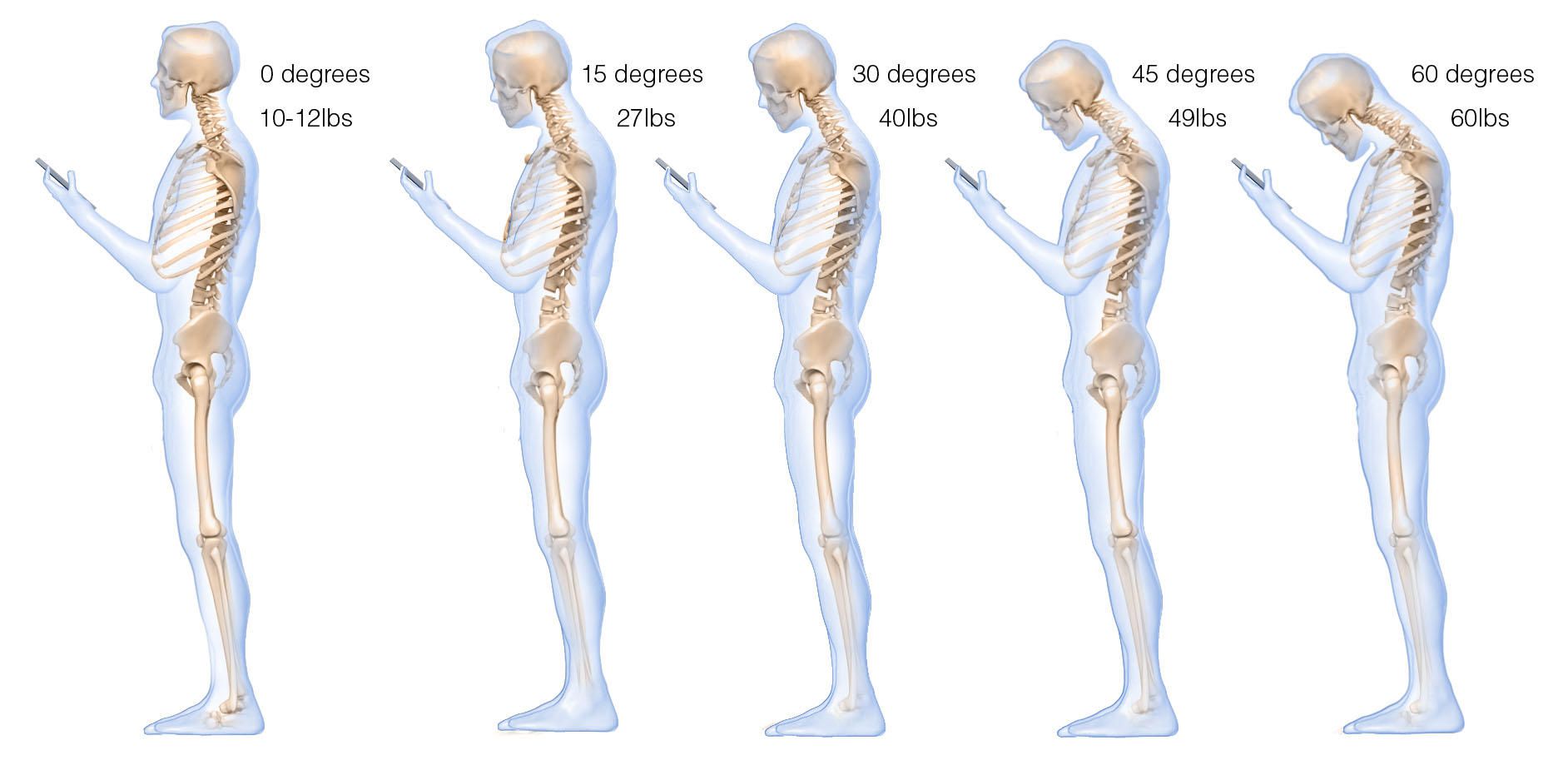 head forward posture