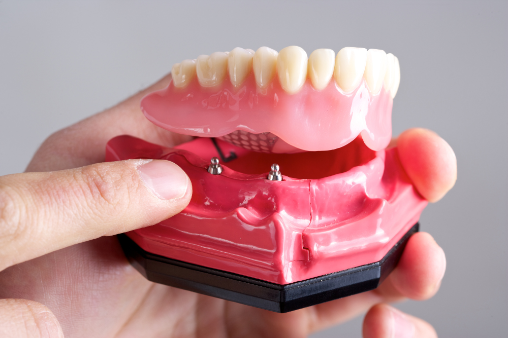 A person is holding a model of a denture in their hand.