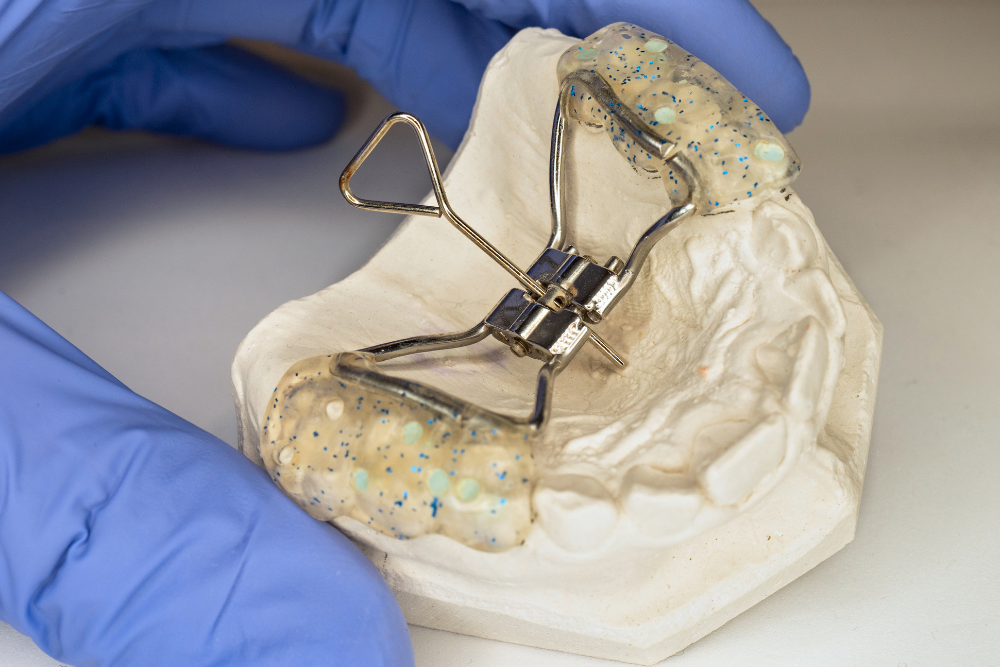 A person wearing blue gloves is holding a model of a tooth with a brace on it.