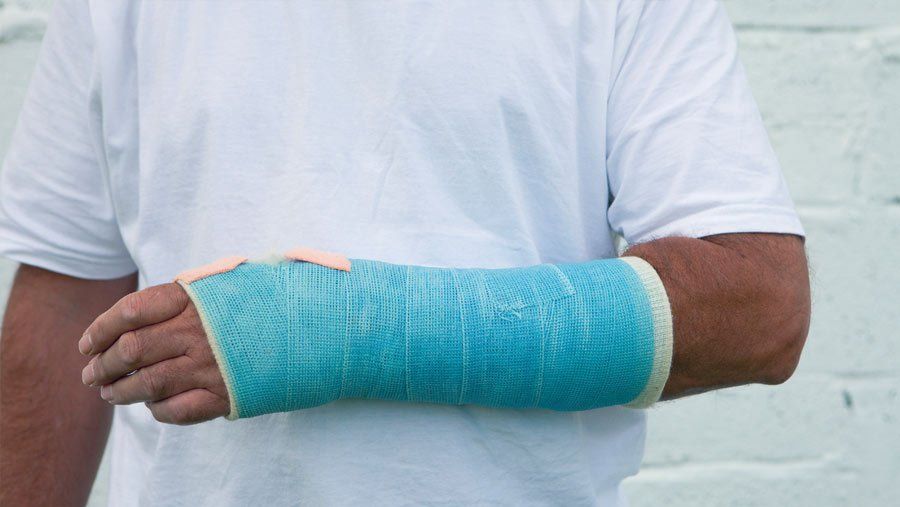 A person with a cast on their arm