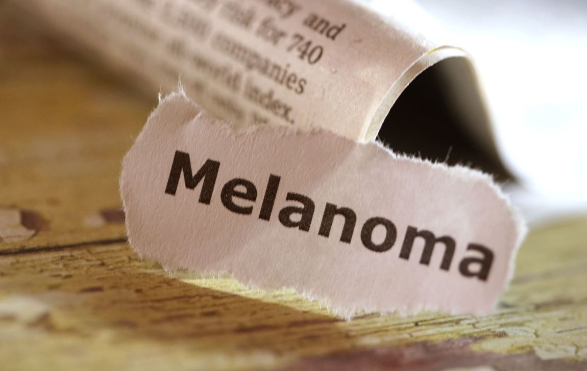 trattamento per melanoma