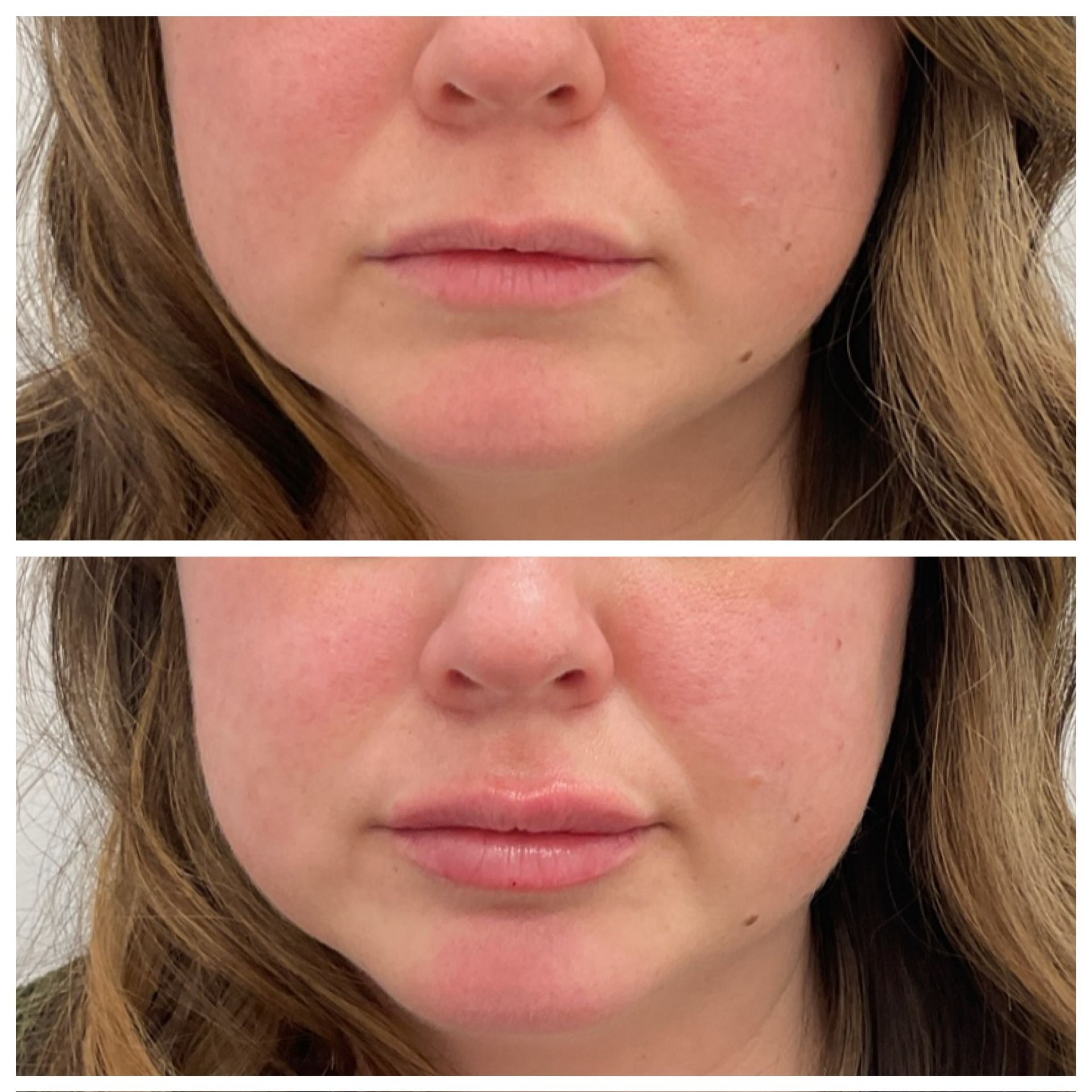 A before and after photo of a woman 's face.